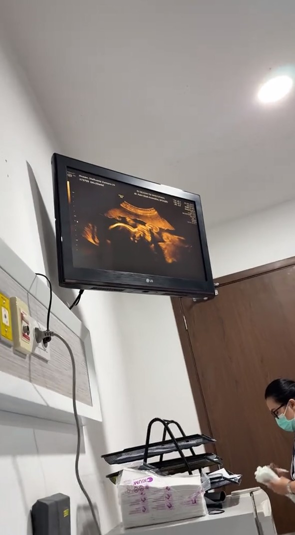 9 Potret Steffi Zamora cek kandungan ditemani Nino Fernandez, foto USG-nya bikin salfok