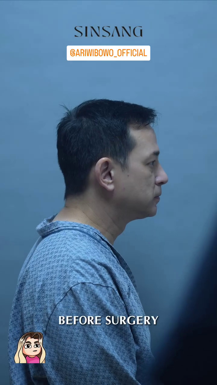 Emoh wajahnya keriput di usia lebih setengah abad, ini 9 potret Ari Wibowo oplas antiaging di Korea