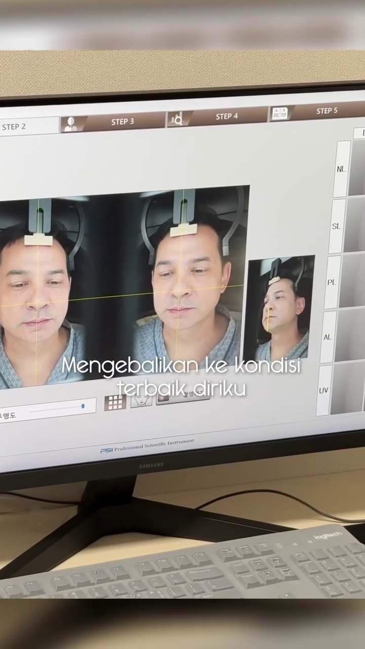 Emoh wajahnya keriput di usia lebih setengah abad, ini 9 potret Ari Wibowo oplas antiaging di Korea