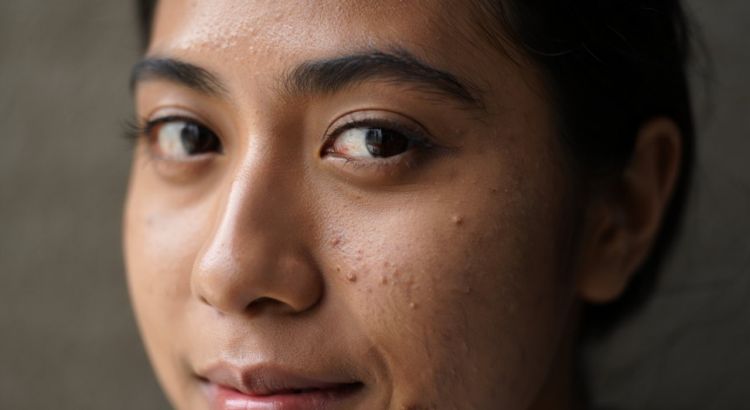 Tanpa disadari, 7 kandungan skincare ini diam-diam perparah pori-pori wajah