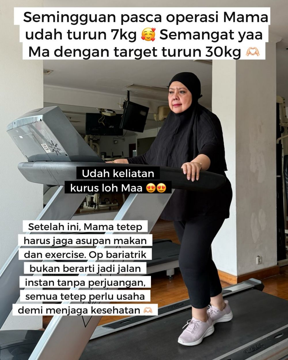 9 Potret transformasi ibu Tasya Kamila setelah operasi bariatrik, berhasil turun 7 kg dalam seminggu