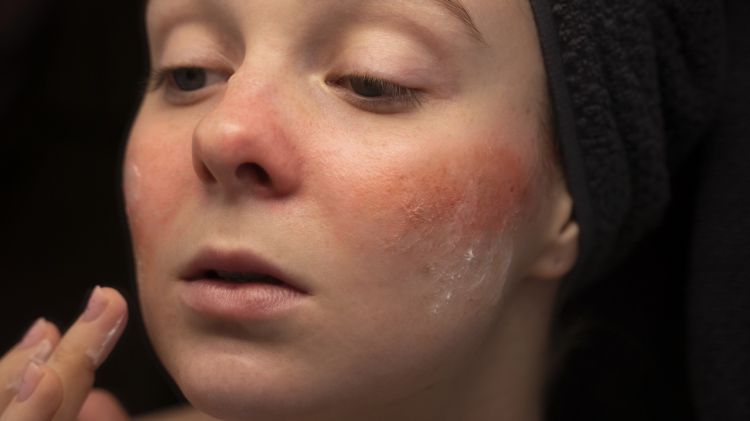 9 Krim malam untuk kulit sensitif, wajah bebas iritasi harga di bawah Rp 150 ribu