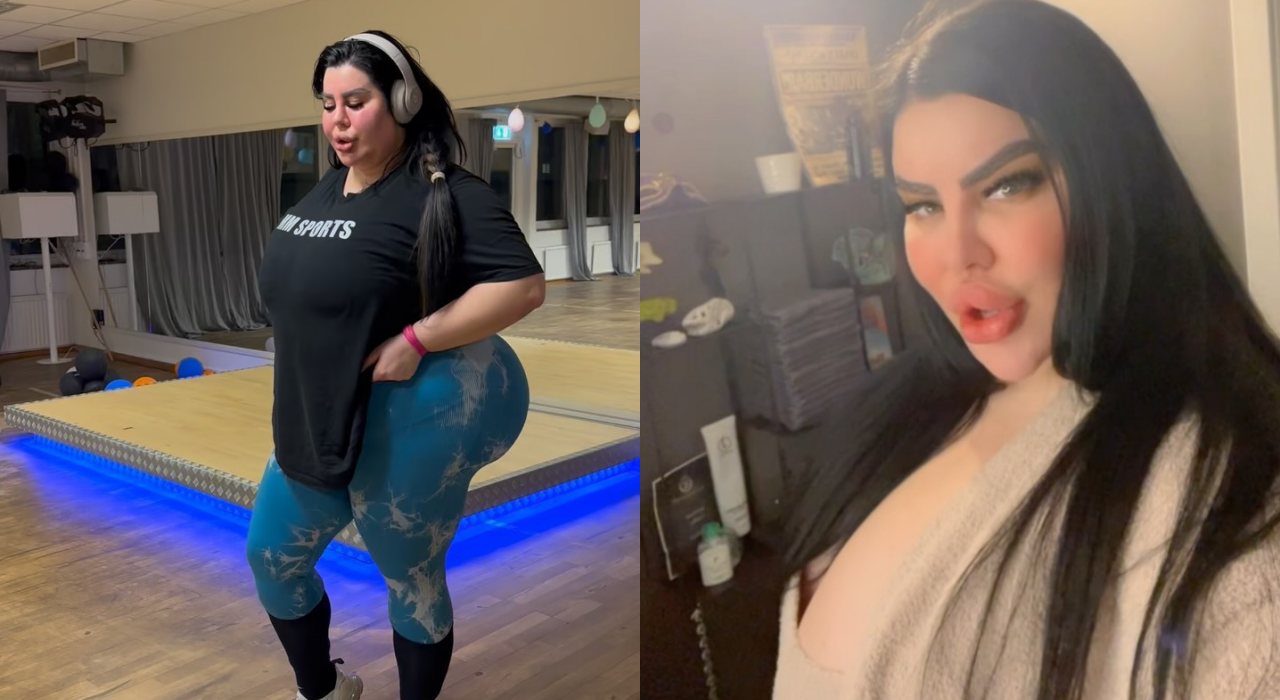 Demi punya bokong terbesar di dunia, model Serbia ini rela suntik 45 kg lemak dalam 9 tahun