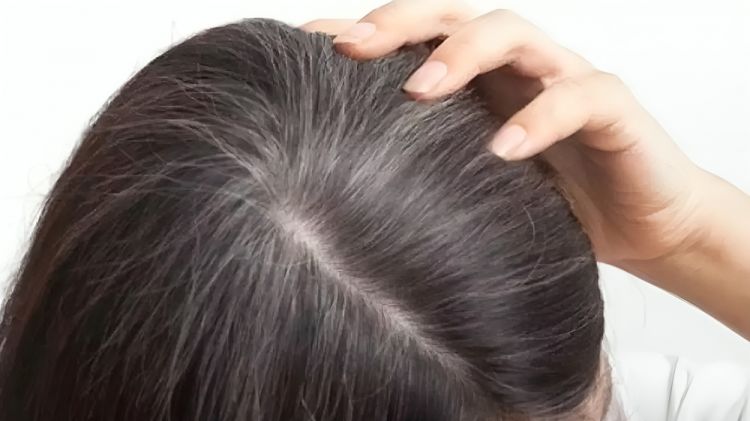 Uban bikin minder? ini trik menghitamkan rambut tanpa semir dan urang-aring, andalkan 1 jenis minuman