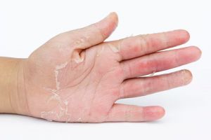 Tanpa dibalur dengan hand mask, ini trik kencangkan tangan keriput cuma andalkan 1 bahan pelembap