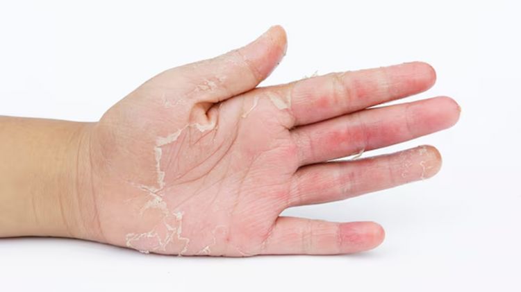 Tanpa dibalur dengan hand mask, ini trik kencangkan tangan keriput cuma andalkan 1 bahan pelembap