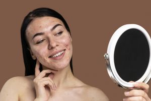 8 Skincare anti aging terbaik, jerawat sirna wajah kembali mulus harga di bawah Rp 150 ribu