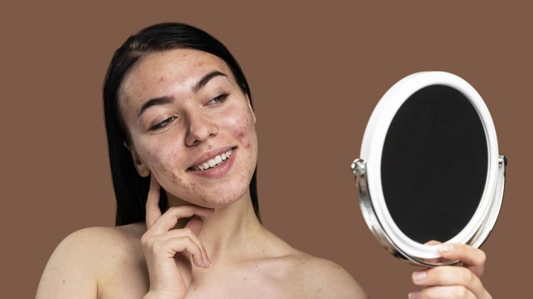 8 Skincare anti aging terbaik, jerawat sirna wajah kembali mulus harga di bawah Rp 150 ribu