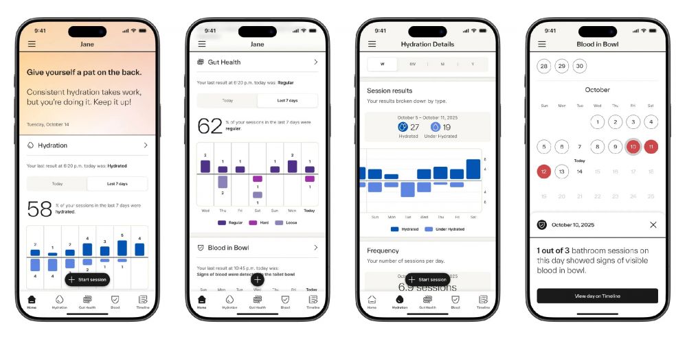Toilet duduk seharga Rp 10 jutaan ini punya kamera buat cek kesehatan perutmu, kok bisa?