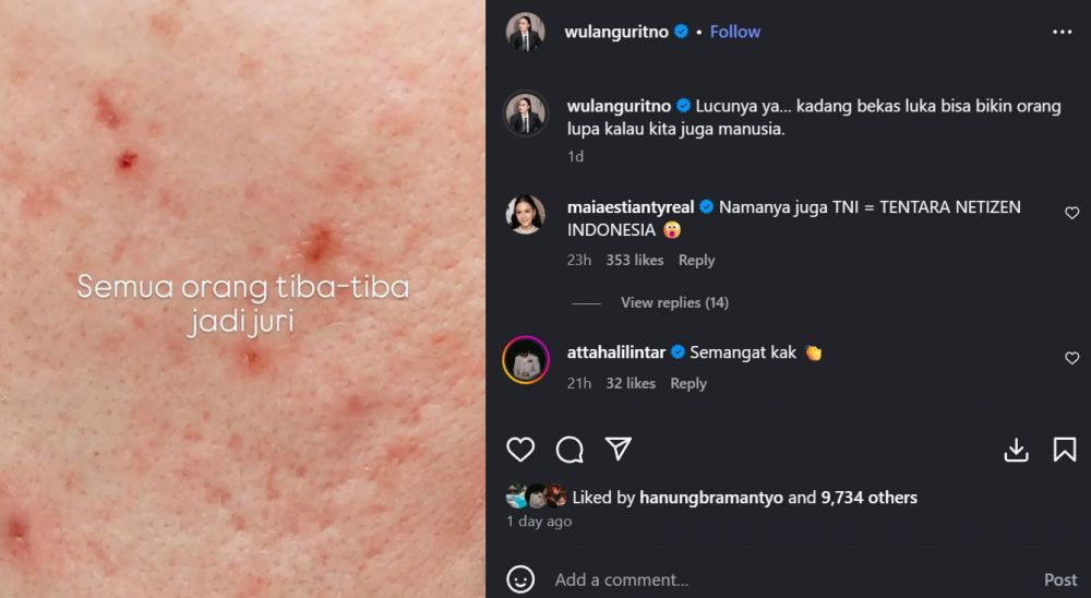 Respons bijak tapi menohok dari Wulan Guritno usai viral wajah aslinya tidak mulus