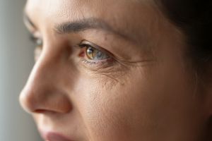 Cara memudarkan kerutan dan garis halus di wajah pakai 1 jenis umbi-umbian, auto mulus seketika