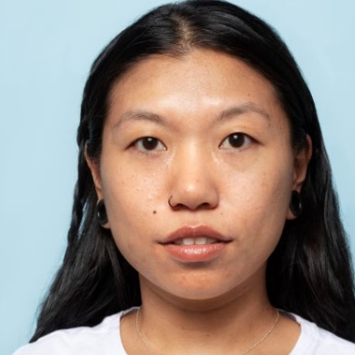 10 Krim pagi menghilangkan bruntusan harga di bawah Rp 150 ribu