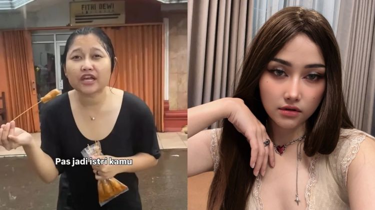 Wajah berubah 180 derajat, 7 potret before-after selebgram usai oplas, Wendy Walter perbaiki hidung