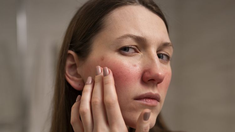 10 Skincare wanita untuk kulit kering dan kusam, wajah lembap lagi harga di bawah Rp 150 ribu