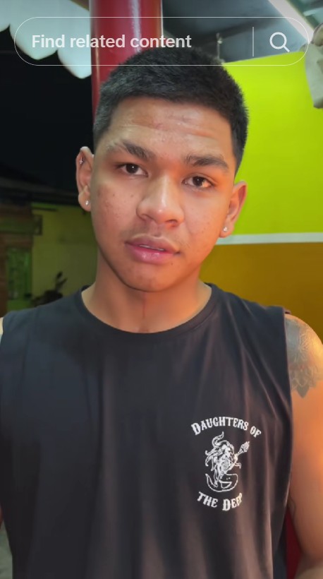 Ingat David Ozora? Korban penganiayaan Mario Dandy yang kini jadi konten kreator, intip 9 potretnya