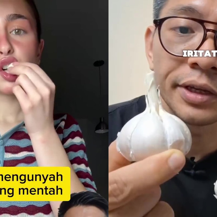 Suka makan bawang putih mentah ternyata bisa picu GERD, pria ini bagikan trik aman mengonsumsinya