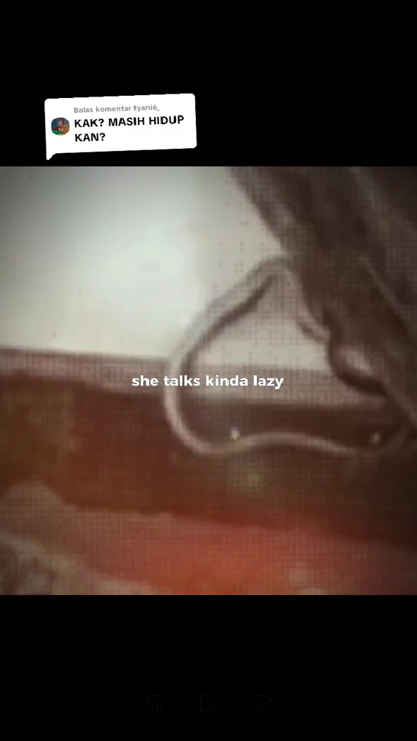 Bangun tidur dikira haid, wanita ini tak sadar paha dililit & digigit ular, ngaku kayak digigit nyamuk