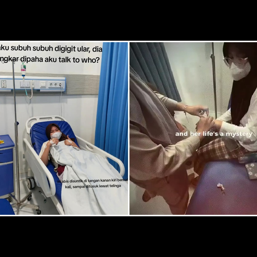 Bangun tidur dikira haid, wanita ini tak sadar paha dililit & digigit ular, ngaku kayak digigit nyamuk