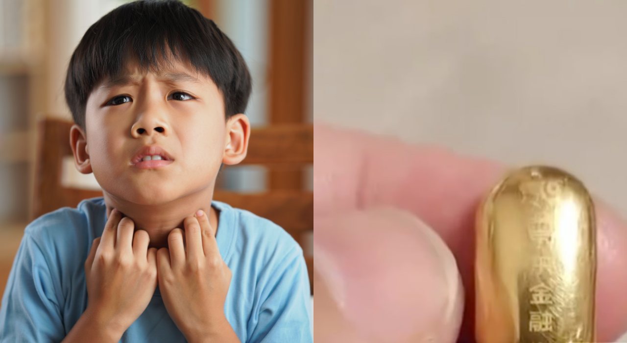 Gara-gara tak sengaja telan emas seharga Rp23 juta, bocah ini dilarang BAB sembarangan