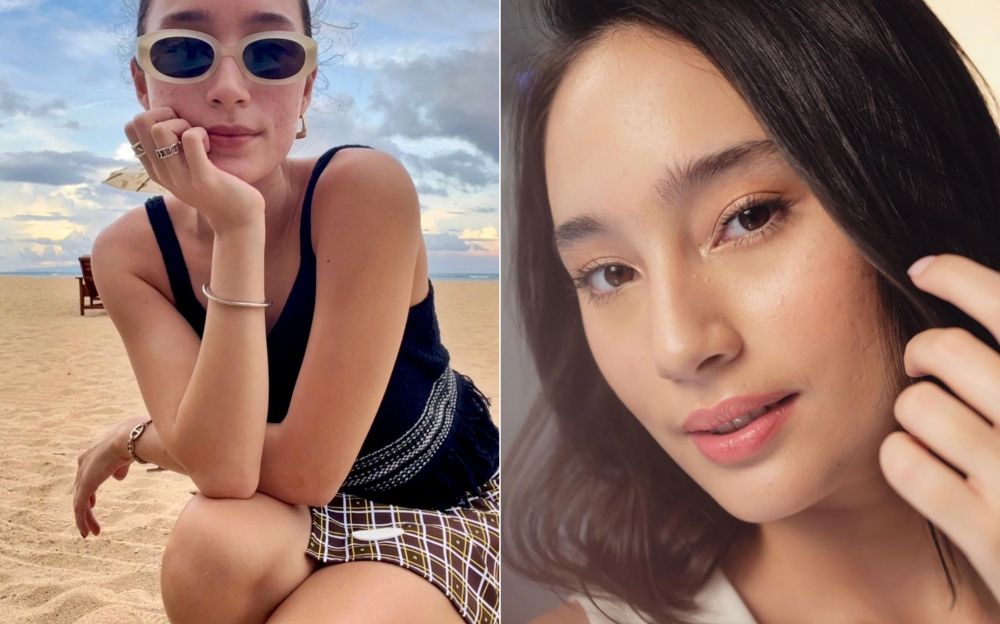 Bukti cantik nggak harus mulus, 11 potret seleb ini tampil percaya diri dengan wajah berjerawat