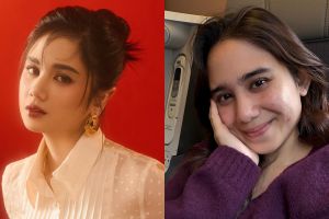 Bukti cantik nggak harus mulus, 11 potret seleb ini tampil percaya diri dengan wajah berjerawat