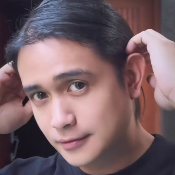 Sempat disebut jadi lebih tua karena oplas, begini 9 penampilan Ajun Perwira usai 8 bulan operasi dagu