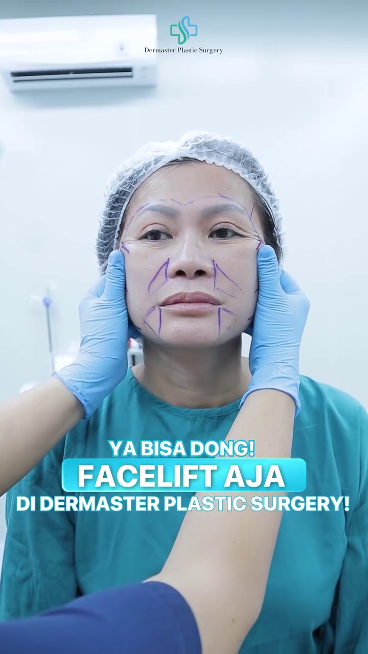 9 Potret transformasi Ci Mehong manglingi usai oplas, usia 54 jadi 30 tahun lebih muda