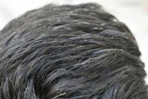 Trik mengubah uban jadi rambut hitam lebat lagi dengan 1 jenis daun, tak perlu pakai urang-aring