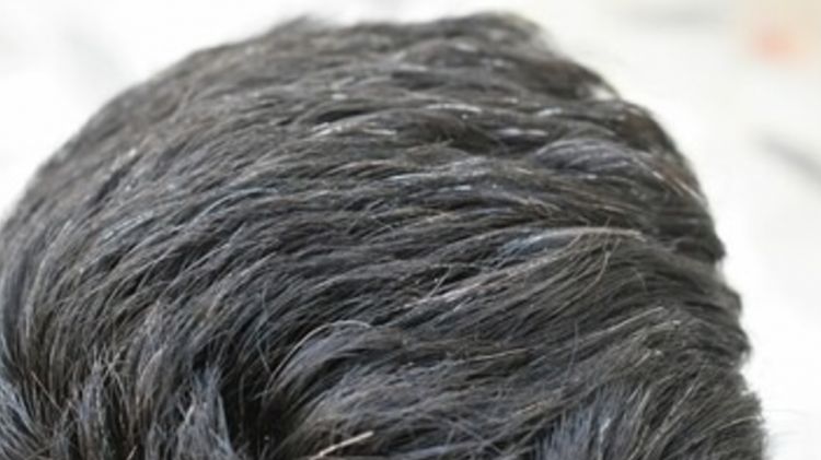 Trik mengubah uban jadi rambut hitam lebat lagi dengan 1 jenis daun, tak perlu pakai urang-aring