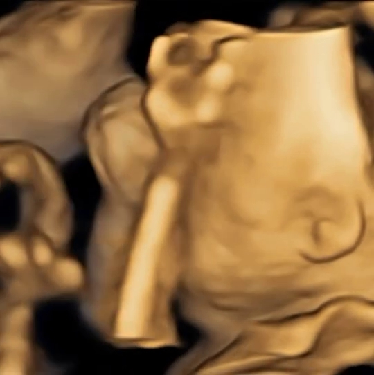 Nino RAN rayakan ulang tahun ke-38, umumkan kehamilan sang istri sebagai kadonya