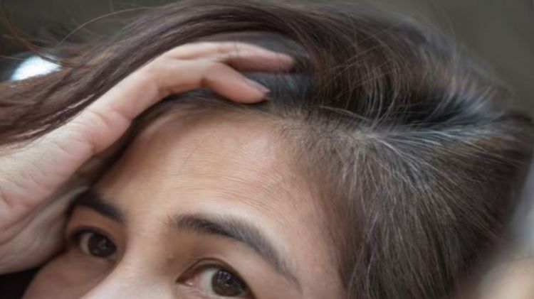 Tanpa semir rambut tetap hitam di usia 30-an tahun, trik mencegah uban prematur pakai 1 jenis rempah