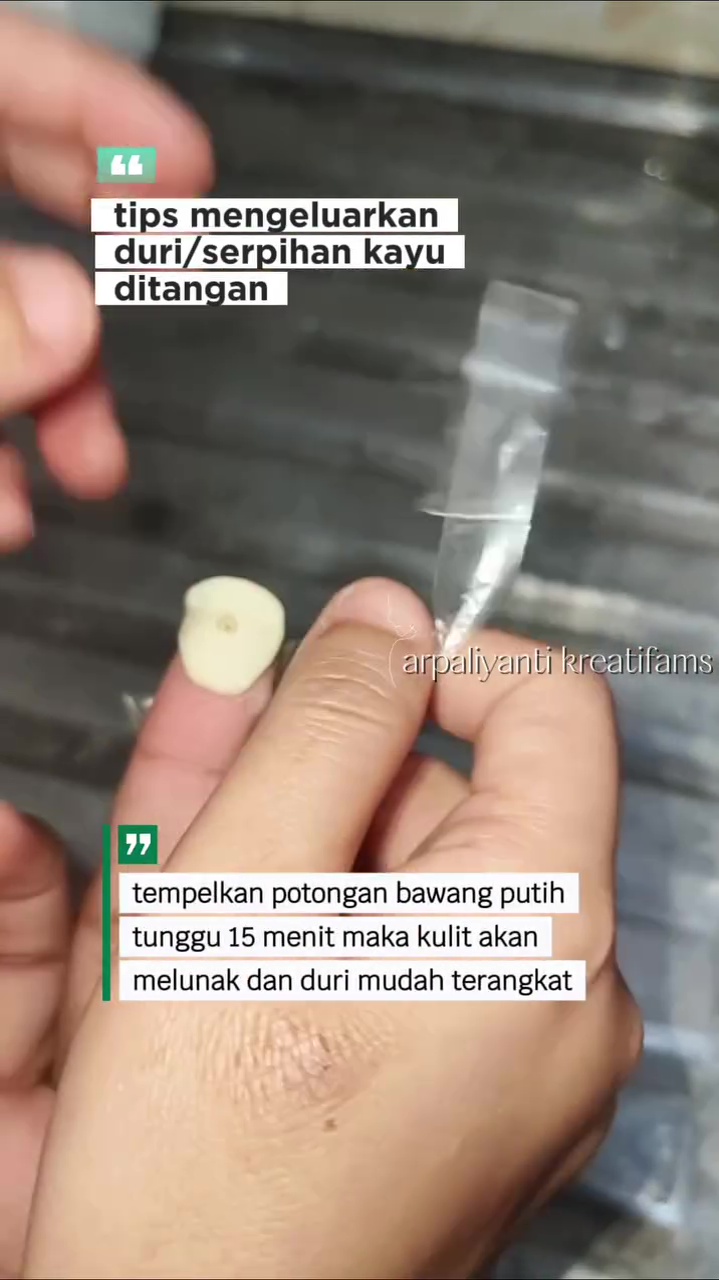 Tanpa rasa sakit, ini trik keluarkan duri di jari tangan pakai 1 bahan dapur, mudah tak perlu dipijat 