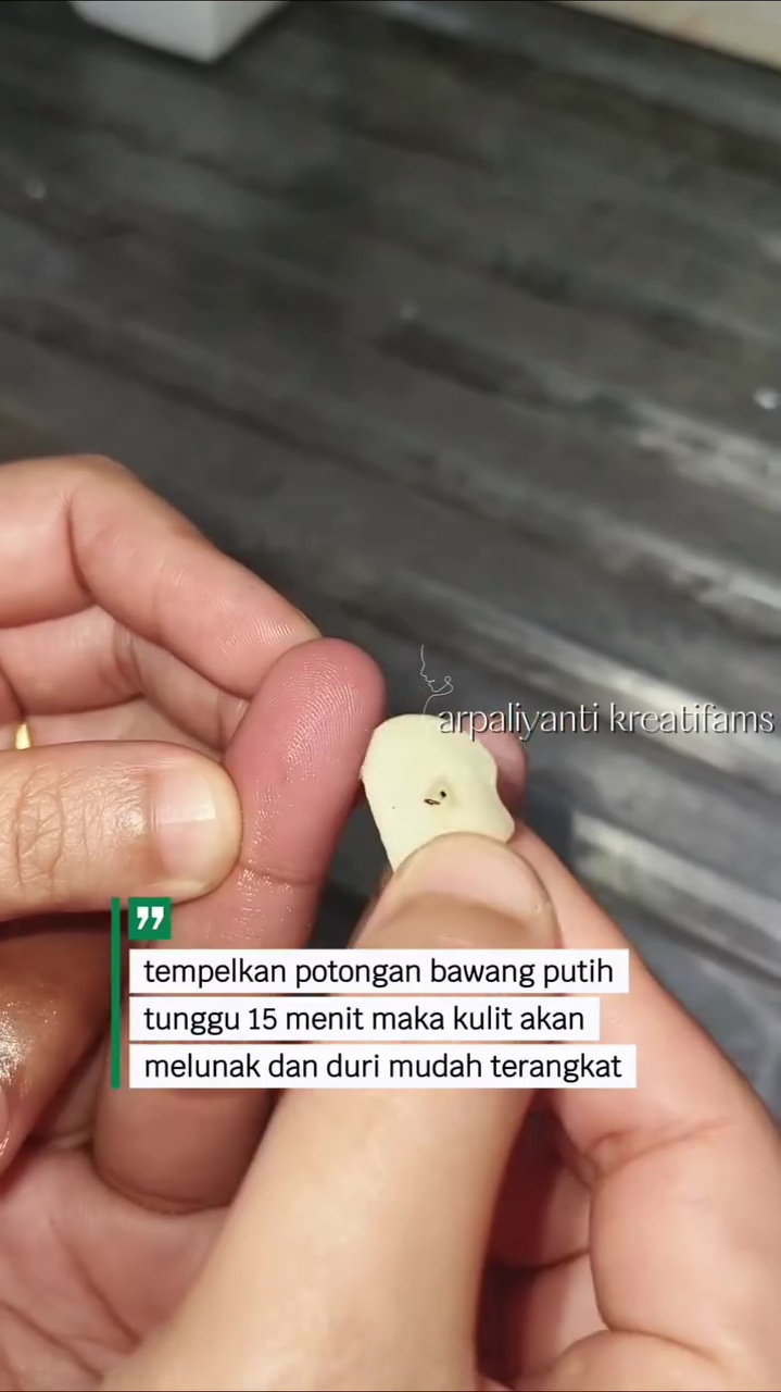Tanpa rasa sakit, ini trik keluarkan duri di jari tangan pakai 1 bahan dapur, mudah tak perlu dipijat 