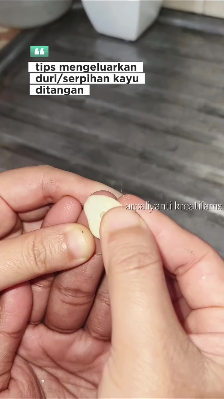 Tanpa rasa sakit, ini trik keluarkan duri di jari tangan pakai 1 bahan dapur, mudah tak perlu dipijat 
