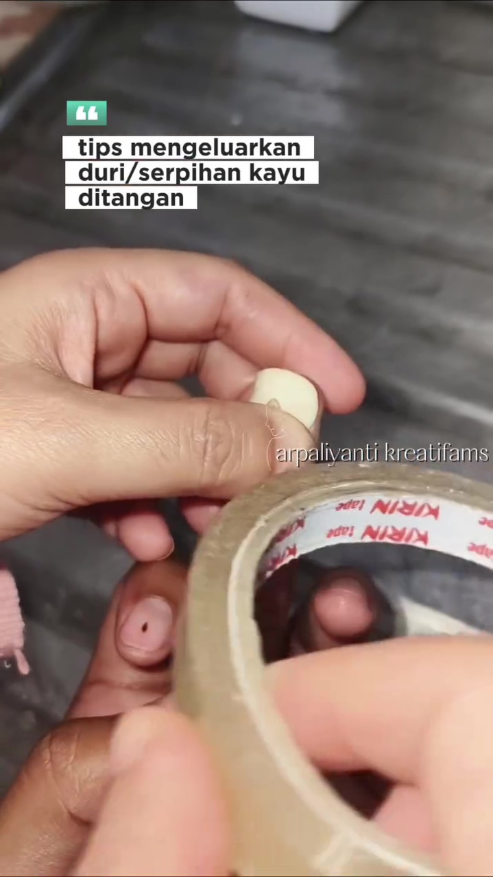 Tanpa rasa sakit, ini trik keluarkan duri di jari tangan pakai 1 bahan dapur, mudah tak perlu dipijat 