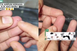 Tanpa rasa sakit, ini trik keluarkan duri di jari tangan pakai 1 bahan dapur, mudah tak perlu dipijat 