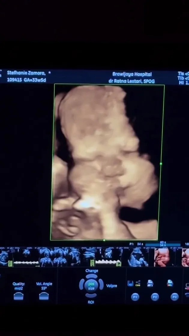 Momen bahagia Steffi Zamora jalani USG jelang persalinan, paras calon buah hati tampak jelas