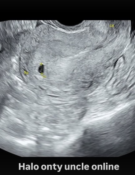 Nikah sebulan kini umumkan kehamilan, Amanda Manopo beri respons kocak bantah hamil duluan