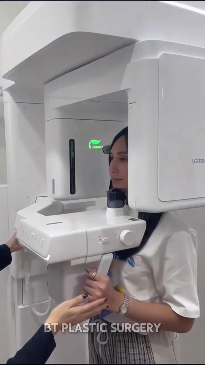 Ingin perbaiki hidung bengkok, ini 7 potret Dena Rachman jalani rhinoplasty dan fat graft