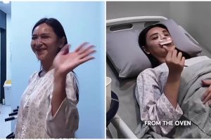Ingin perbaiki hidung bengkok, ini 7 potret Dena Rachman jalani rhinoplasty dan fat graft
