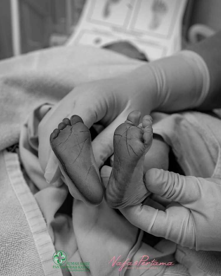 Sambut anak pertama, ini 9 potret Nita Vior jalani persalinan caesar, sempat jalani induksi balon