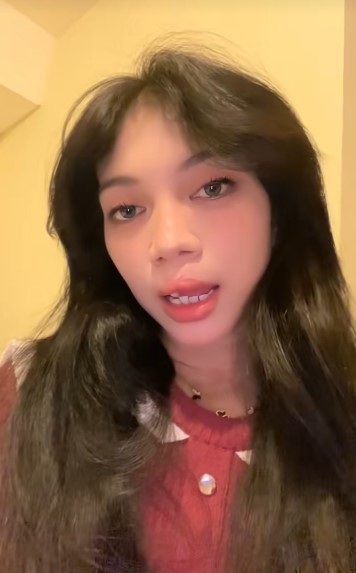 Ingat gadis bibir sumbing yang dioperasi gratis oleh Dokter Tompi? 9 potret terbarunya manglingi abis