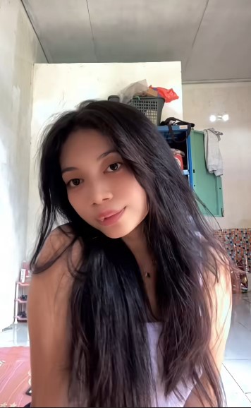 Ingat gadis bibir sumbing yang dioperasi gratis oleh Dokter Tompi? 9 potret terbarunya manglingi abis