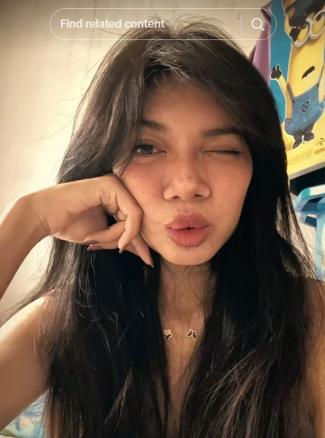 Ingat gadis bibir sumbing yang dioperasi gratis oleh Dokter Tompi? 9 potret terbarunya manglingi abis