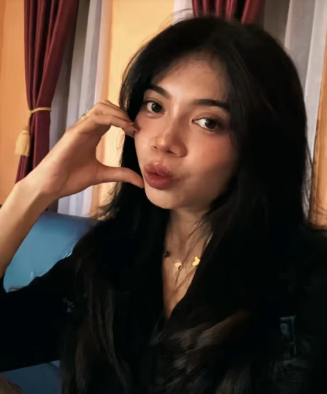 Ingat gadis bibir sumbing yang dioperasi gratis oleh Dokter Tompi? 9 potret terbarunya manglingi abis