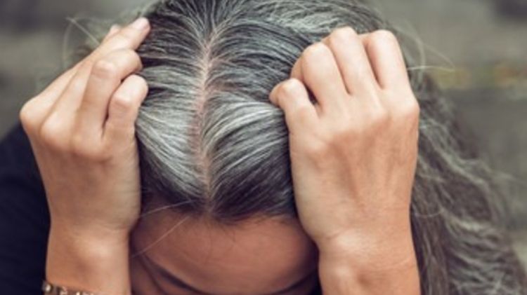 Kembalikan rambut putih uban jadi hitam lagi tanpa jintan, cuma dengan tambahan 2 bahan dapur