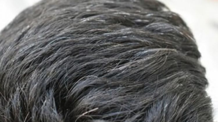 Hitamkan rambut beruban agar lebih muda lagi tanpa semir, pakai 1 jenis sayuran