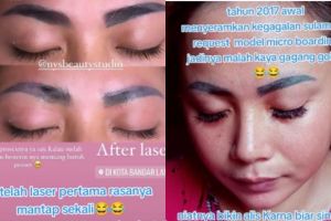 Cewek ini bagikan kisahnya saat laser alis penuh perjuangan, hasilnya di luar ekspektasi
