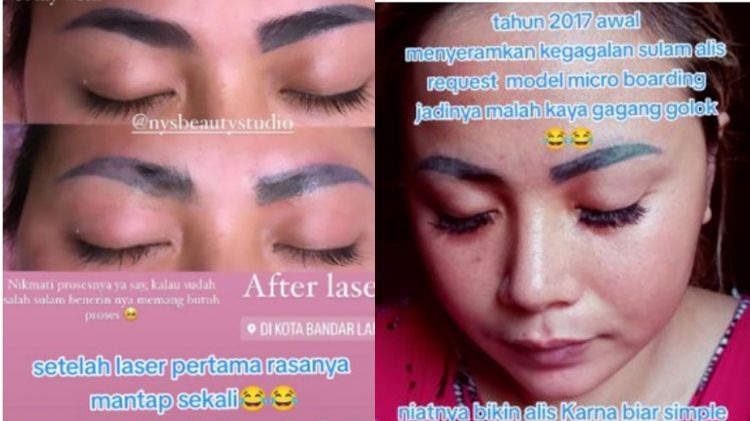 Cewek ini bagikan kisahnya saat laser alis penuh perjuangan, hasilnya di luar ekspektasi