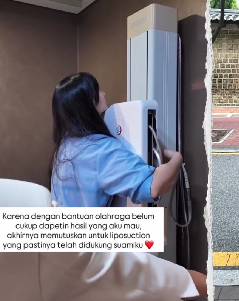 Asmirandah ingin badan ideal pasca melahirkan, putuskan sedot lemak, ini 9 potret hasilnya